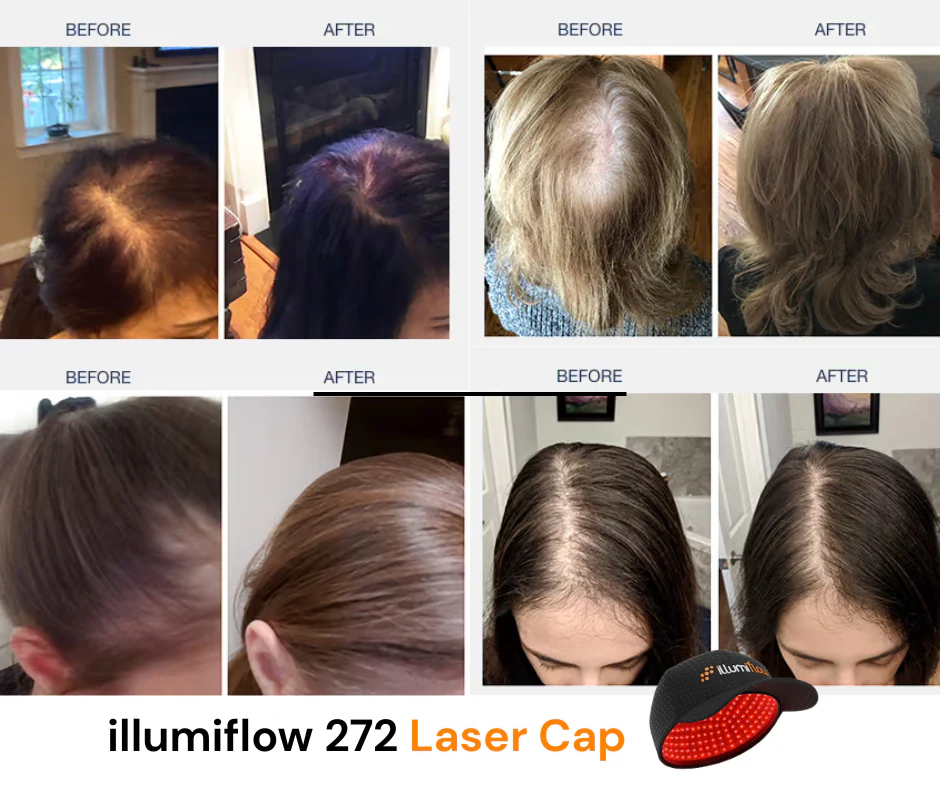 illumiflow 272 Pro Laser Cap - Loved By Women - Image 4